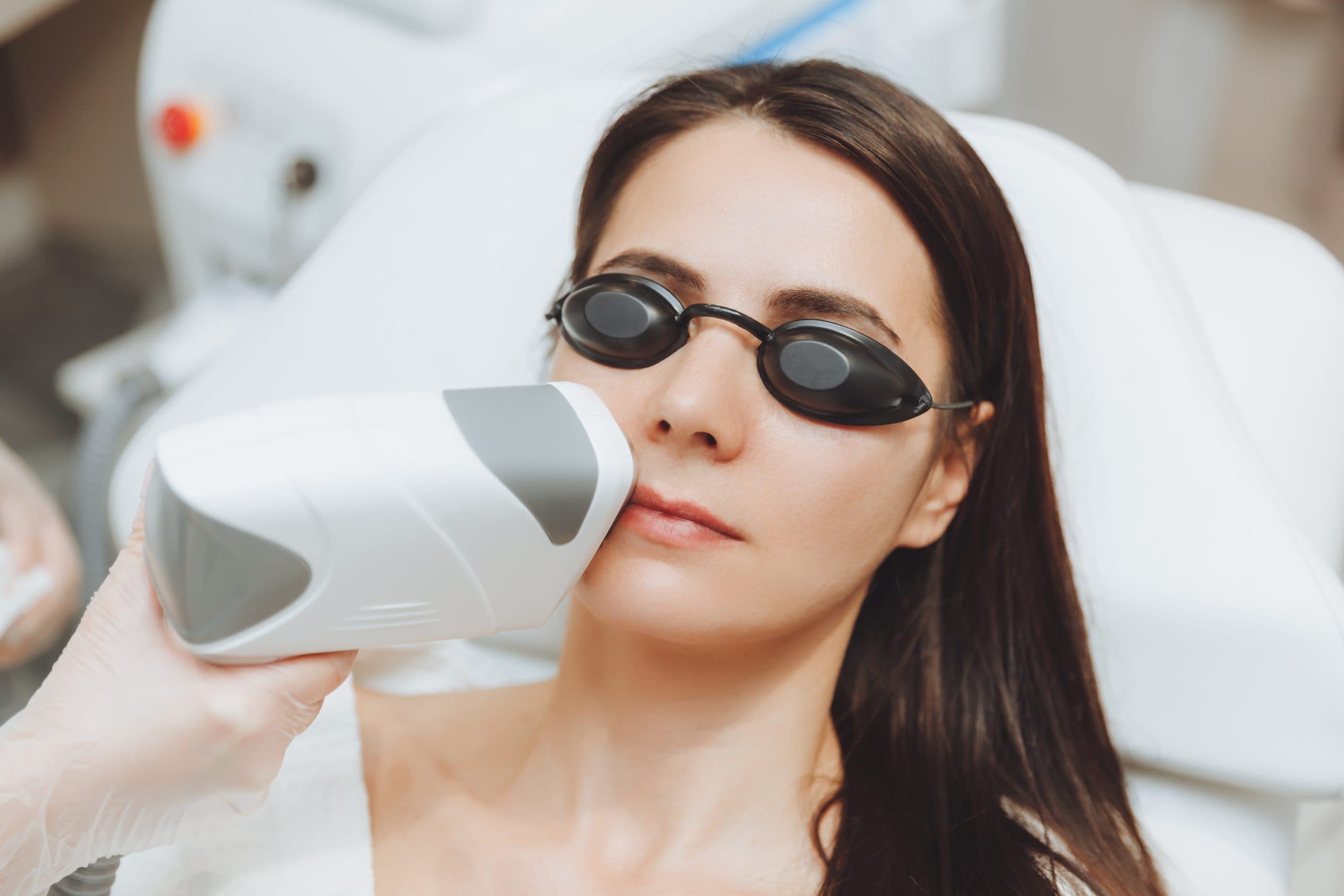 séance épilation laser sur le visage d'une femme