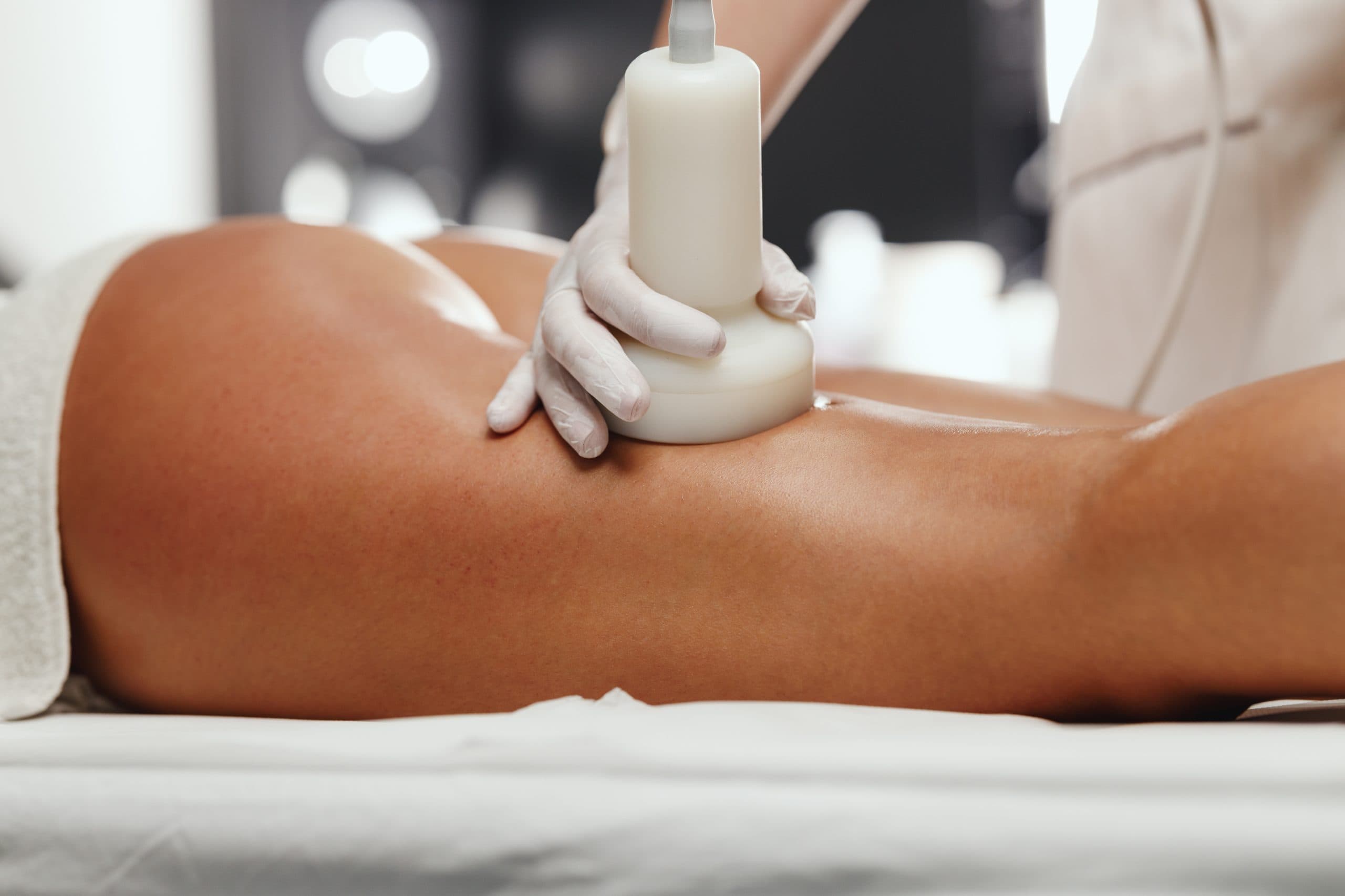 traitement avec un appareil anti cellulite